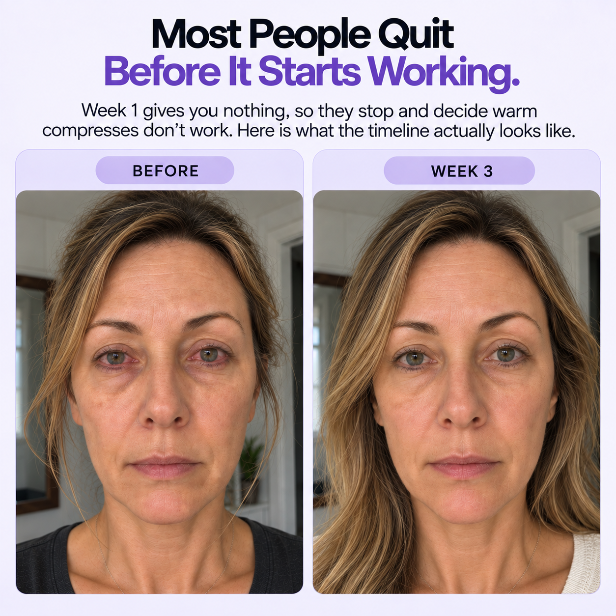 Oculair Gentle Steam Therapy